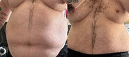 James’s one-year Mounjaro transformation – over 100lbs lost, waist size dropped from 58 to 46, major boost in strength and flexibility